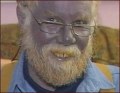 Blue man Paul Karason